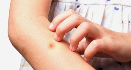 Невидима загроза в траві: жителі Дніпропетровщини скаржаться на дивні укуси (ФОТО)