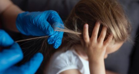 У Кривому Розі різко збільшилася кількість випадків педикульозу