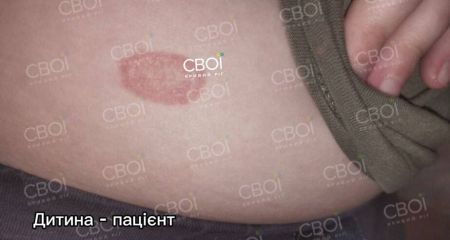 У Кривому Розі у відвідувачів котокафе з’явився лишай: обставини інциденту (ФОТО)