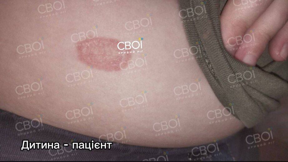 У Кривому Розі у відвідувачів котокафе з’явився лишай: обставини інциденту (ФОТО)