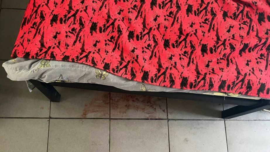 Избиение в больничной палате: житель Днепропетровщины жестоко побил соседа по койке на Ровенщине (ФОТО)