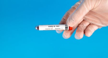 В Днепропетровской области фиксируют случаи смерти от COVID-19, а также ботулизм