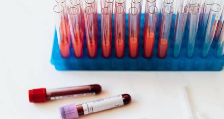 В Днепропетровской области растет заболеваемость ОРВИ