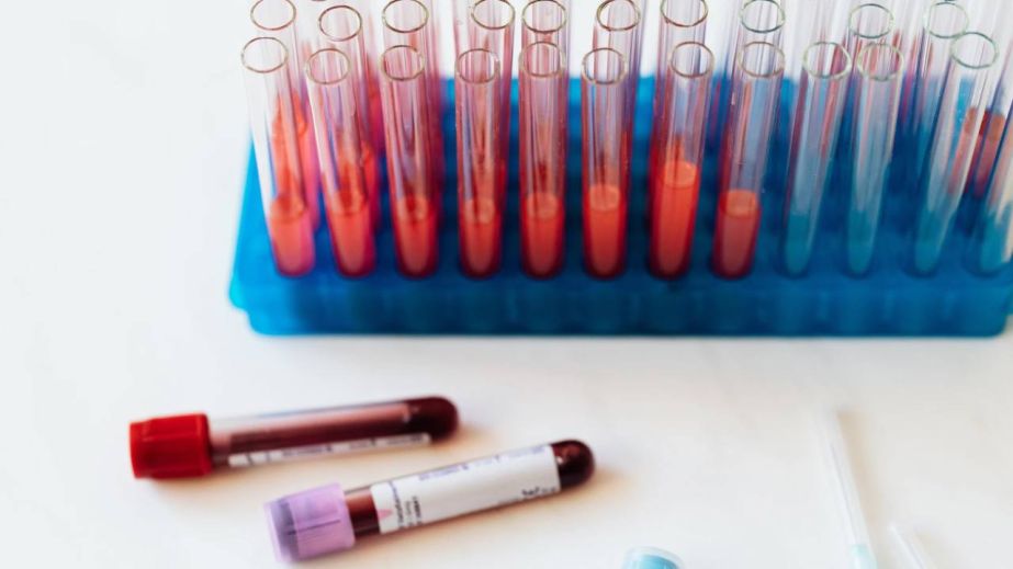 У Дніпропетровській області зростає захворюваність на ГРВІ