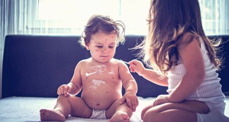 В Днепре двое детей из одной семьи заболели корью