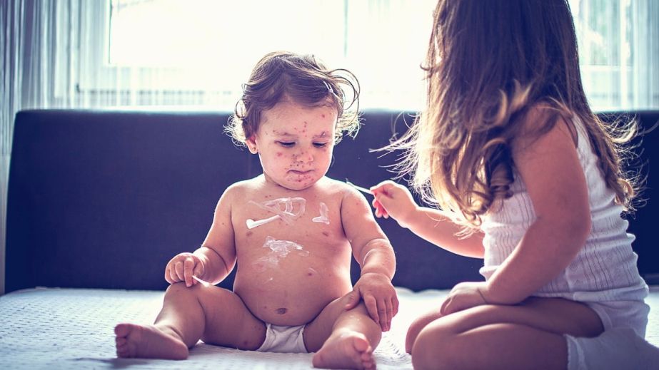 У Дніпрі двоє дітей з однієї родини захворіли на кір