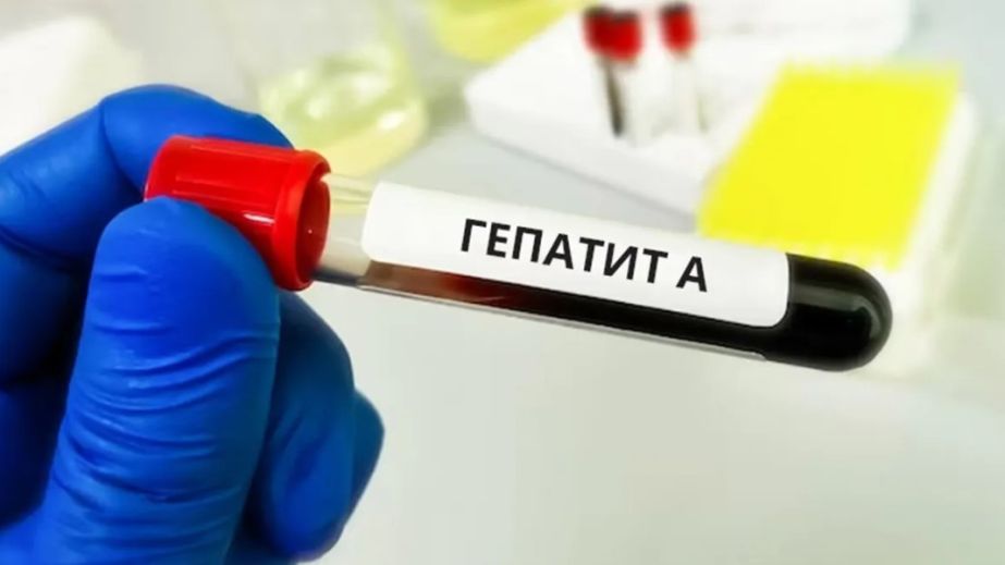 Вспышка гепатита А в Украине: какая ситуация в Днепропетровской области