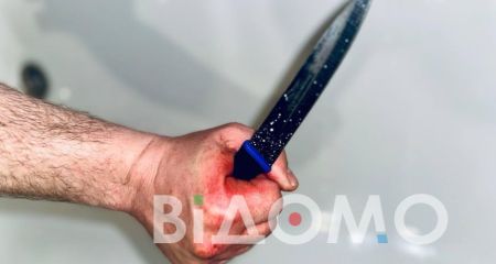 У Дніпрі чоловік через ревнощі всадив гостеві ножа у живіт (ФОТО)