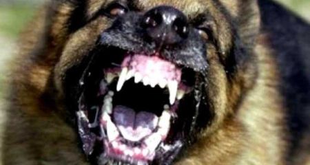 У Кривому Розі вівчарка пошматувала дівчині обличчя (ФОТО 18+)