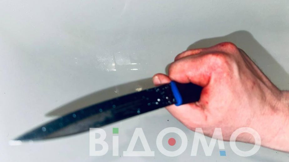 Пирнув знайому ножем у живіт: у Кам'янському затримано 32-річного зловмисника (ФОТО)