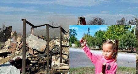 Тяжело травмированной девочке из Днепропетровщины ампутировали ножку в результате российского обстрела