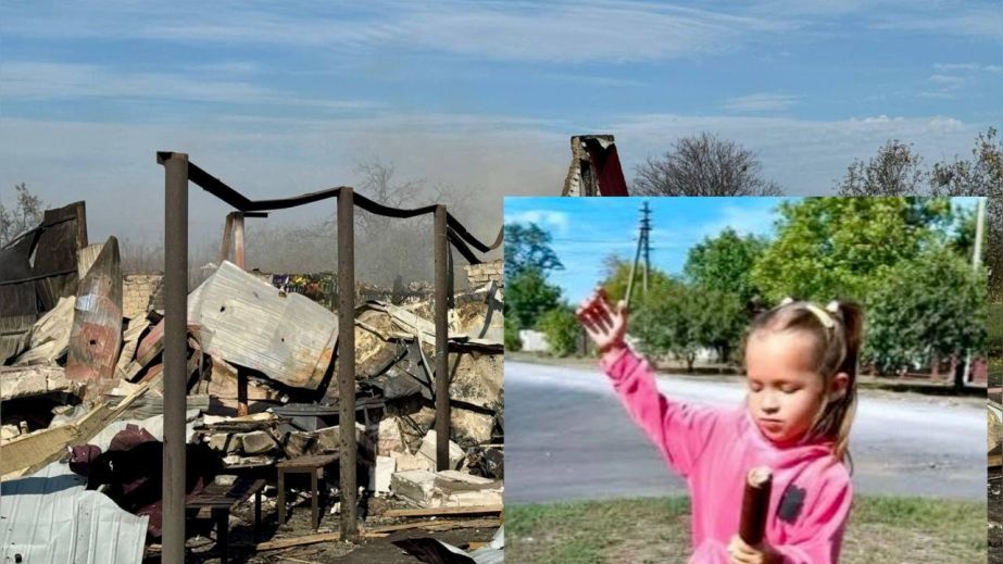 Тяжело травмированной девочке из Днепропетровщины ампутировали ножку в результате российского обстрела