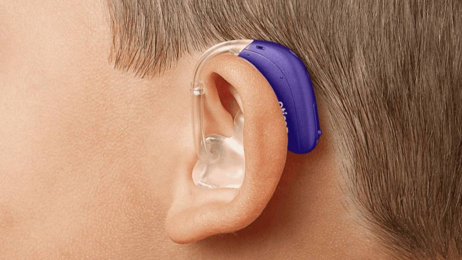 Днепряне могут получить бесплатные современные слуховые аппараты: что известно