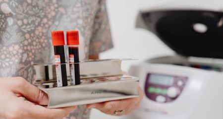 Спалах кору зафіксували в одній з гімназій у Дніпрі